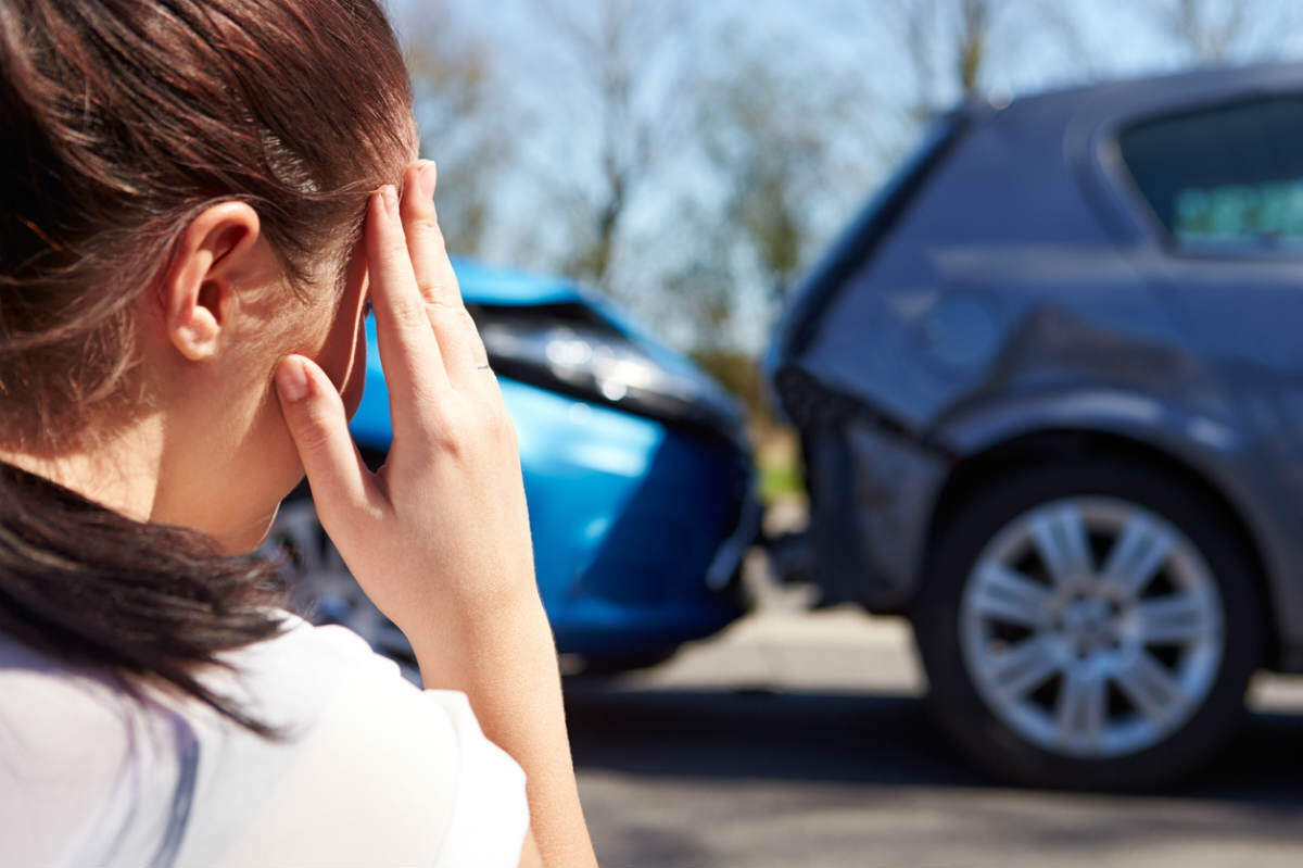 Malar Fracture after car accident