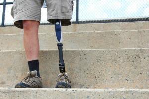 St. Louis car crash victim with prosthetic leg
