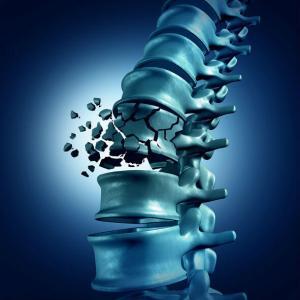 broken back from a car accident st louis injury lawyer broken back from a car accident st louis injury lawyer