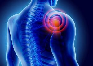 St. Louis Car Accident Lawyer