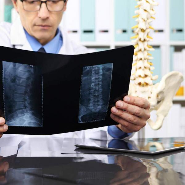 doctor looking at x-rays