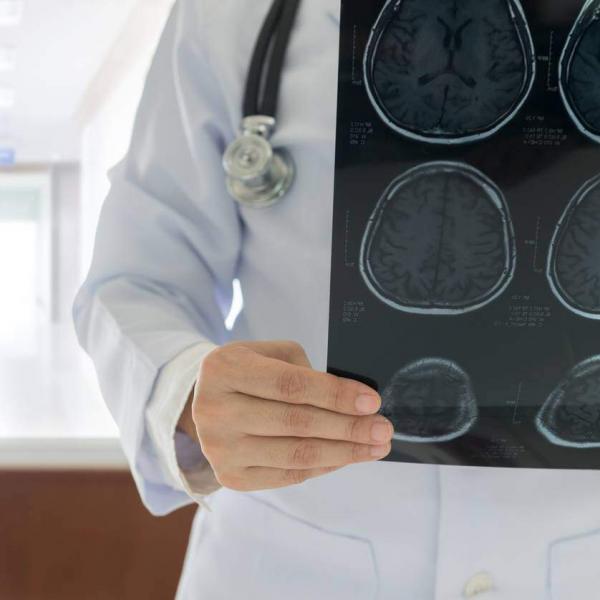 Neurologist examing brain scans