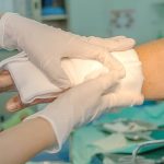 burn-injuries-in-car-accidents-how-st-louis-attorneys-can-help