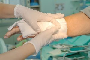 burn-injuries-in-car-accidents-how-st-louis-attorneys-can-help